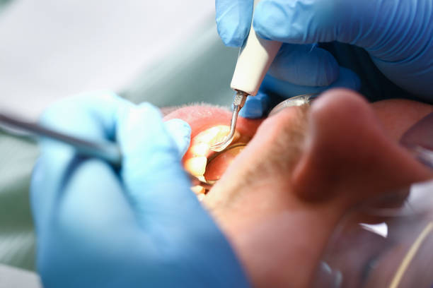 Best Emergency Broken Tooth Repair in Valley Falls, RI