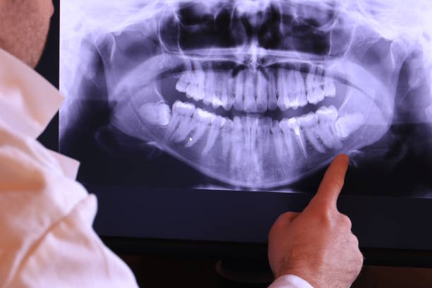Best Emergency Tooth Extraction in Valley Falls, RI