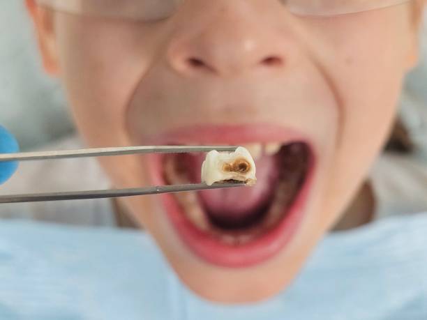 Best Emergency Dental Care for Trauma or Injury in Valley Falls, RI