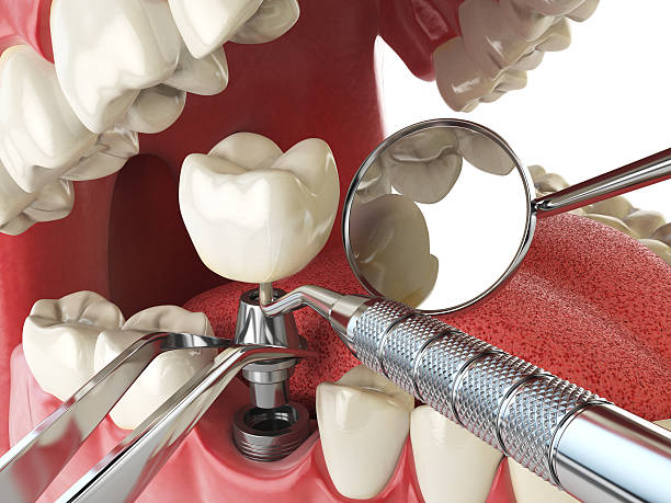 Fast & Reliable Emergency Dental Services in RI